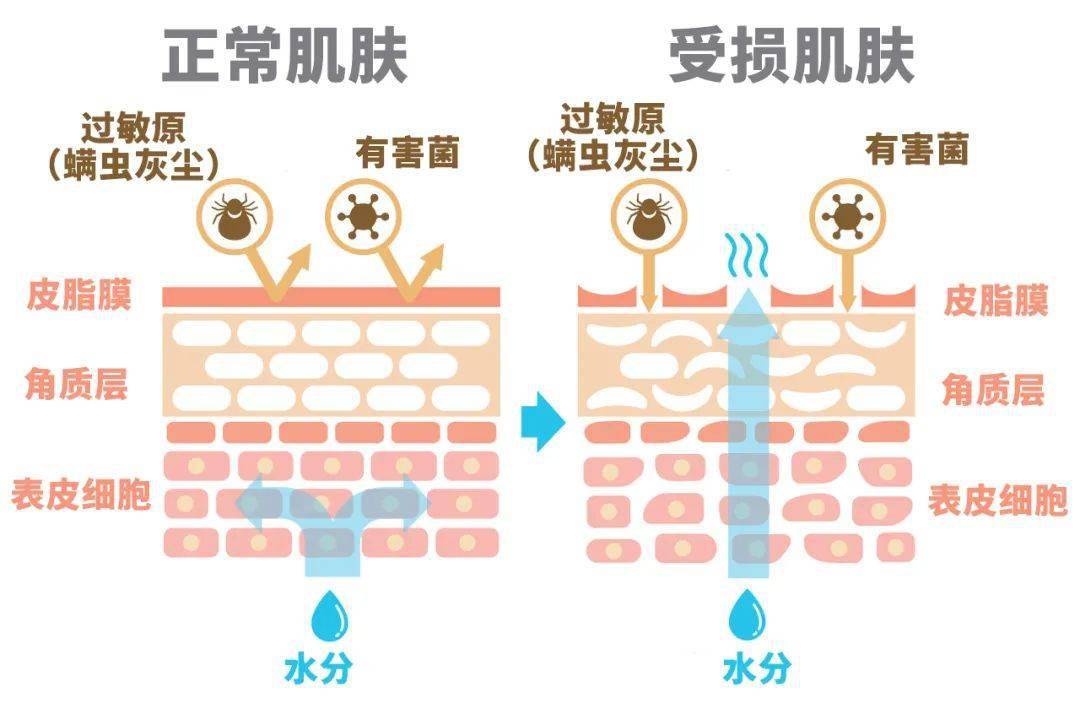 我们的表皮肌肤大概分成  皮脂膜,角质层和表皮细胞