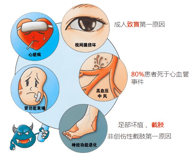 三,身体体质指数>24(肥胖型糖友) 更严重的是,糖尿病可以引起失明