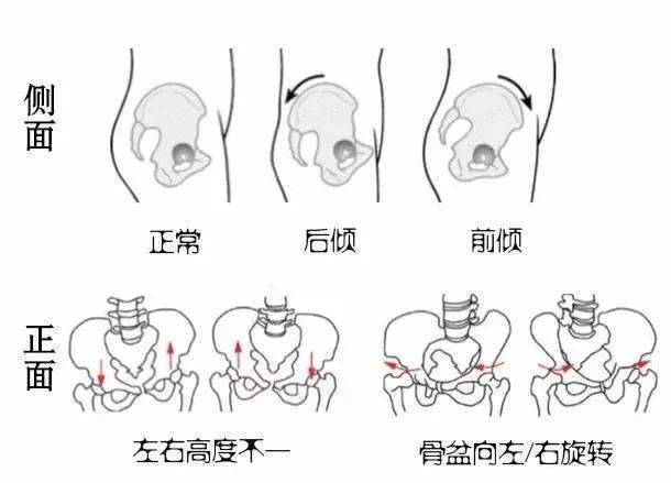 11道题自测骨盆倾斜度