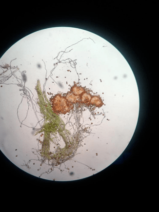 显微镜下的华西委陵菜锈病菌 (phragmidium potentillae   来源:作者