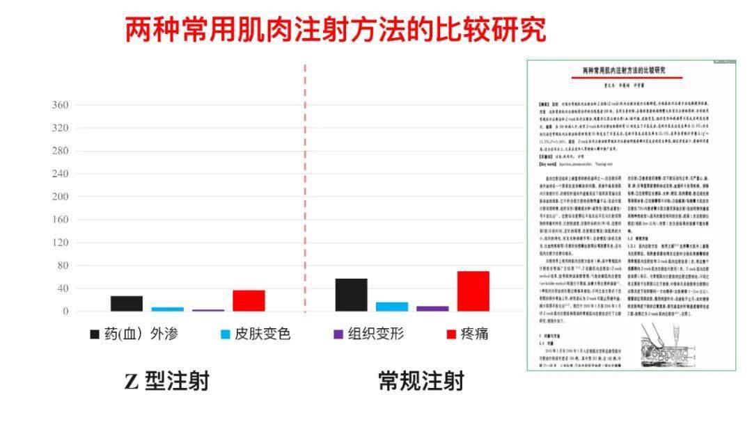 pptz型注射法