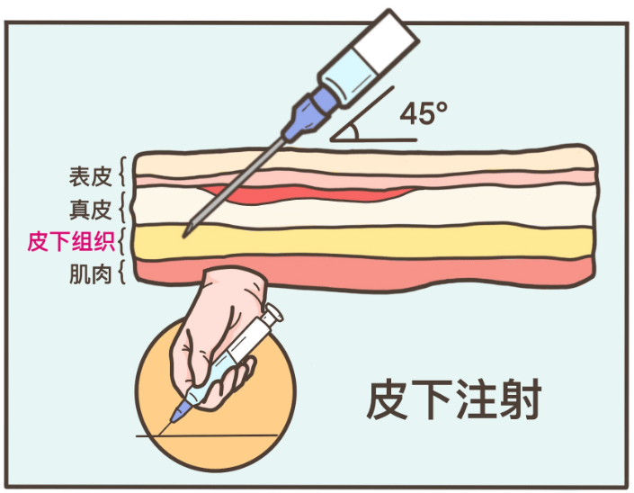 比如在医院时为糖尿病患者注射的胰岛素,童年的麻腮风疫苗,拔牙前的