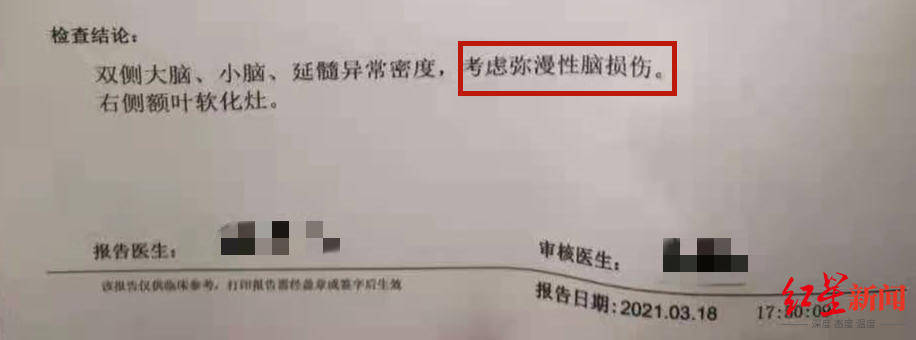 小军的脑部ct光片及西安市儿童医院3月18日出具的相关报告.