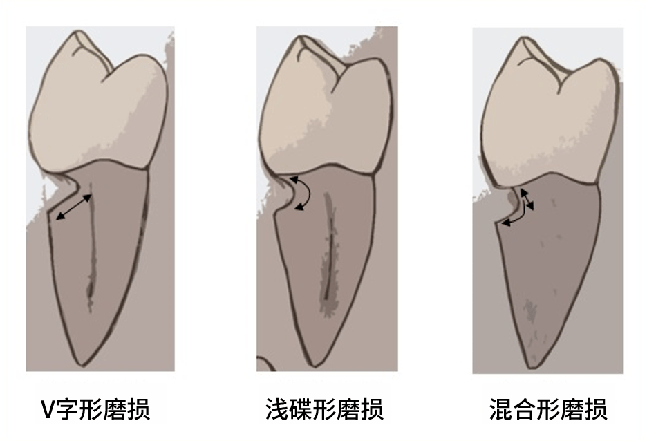 是谁,把牙齿送上了"断头台"?