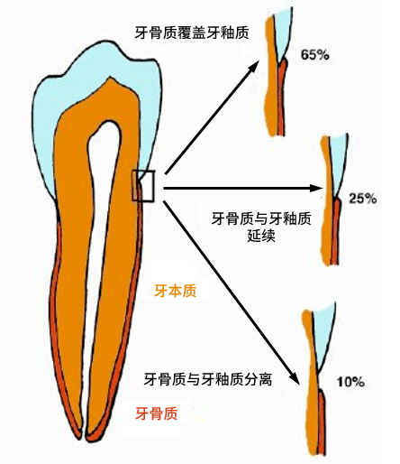 没有之一;牙根(深埋在牙龈里的部分)的外壳由牙骨质构成,其强度和厚度