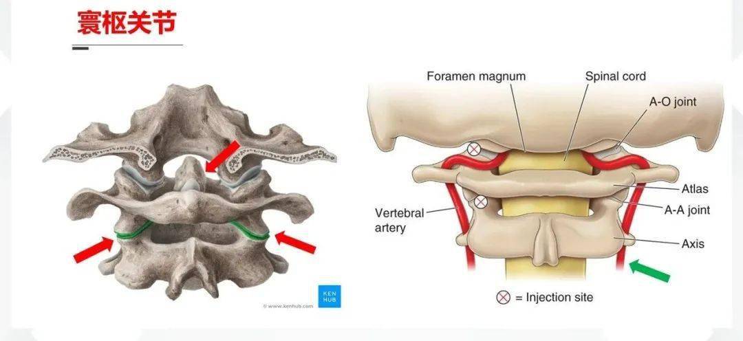 寰枢关节的三个小关节(下图红色箭头,形成稳定的关节活动;两侧有同侧