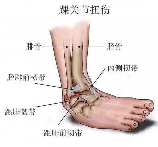 干货脚踝扭伤系统康复训练