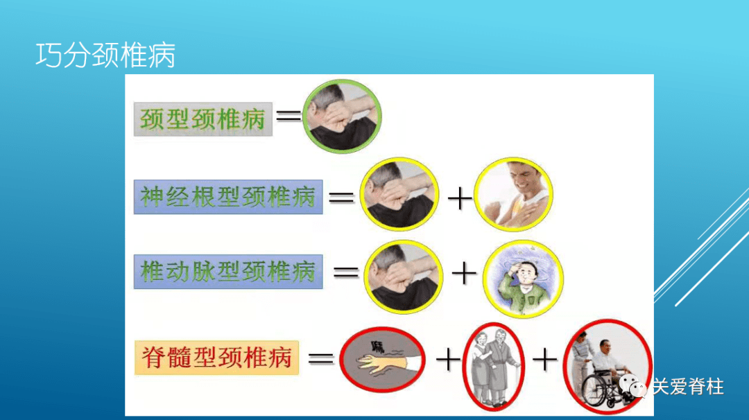 一文教您认识颈椎病分类与治疗