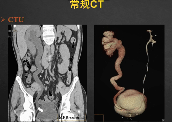 ctu是什么意思 来自搜狐网