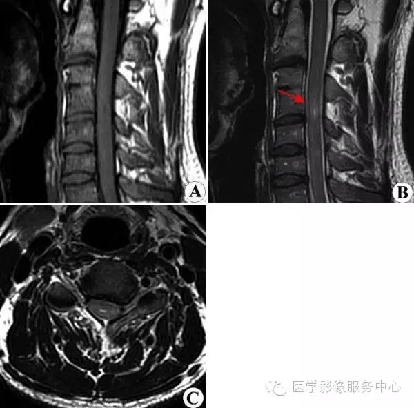 一文看懂 | 典型骨肌病例(x ct mr)