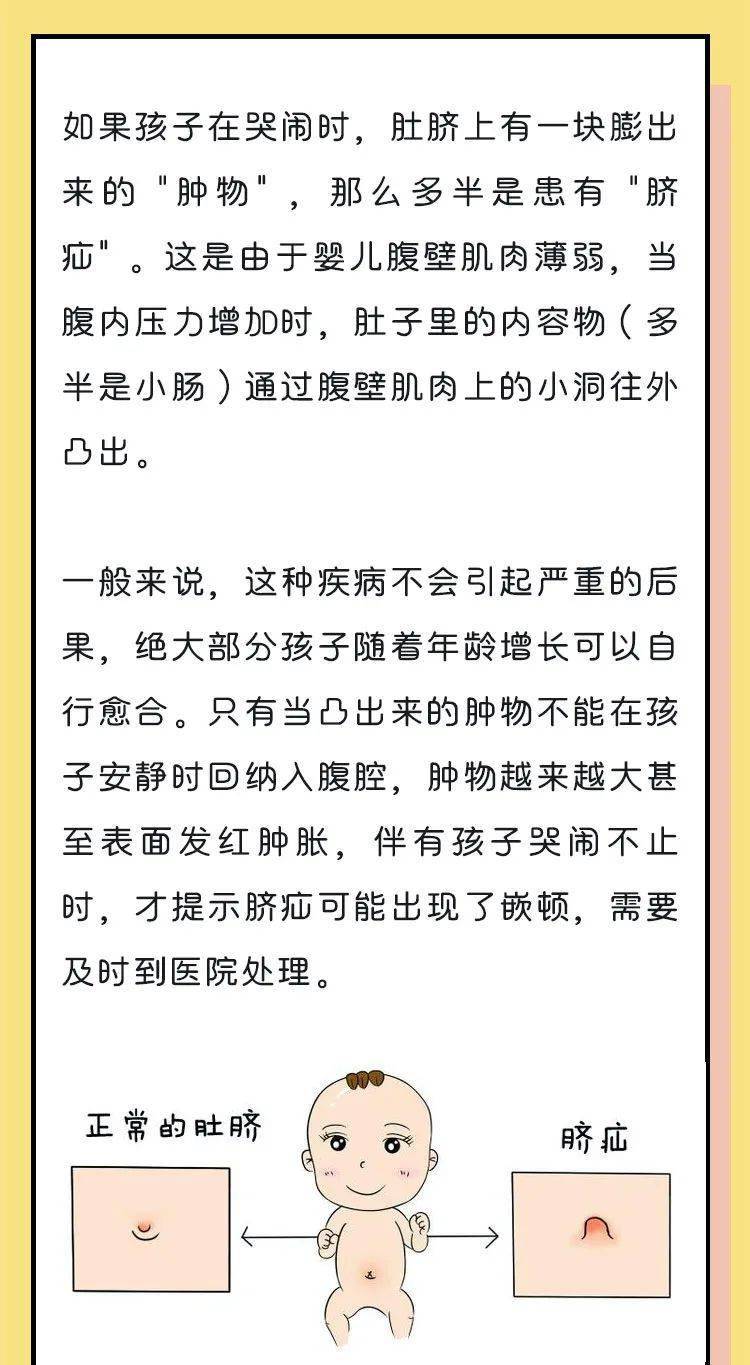 被误解的肚脐眼儿:孩子着凉真不怪我!