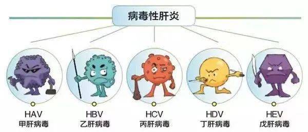 专指病毒性肝炎,依病毒种类可分为甲肝,乙肝,丙肝,戊肝,丁肝