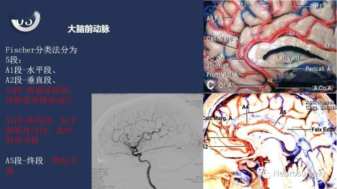 高清头颈动脉系统解剖
