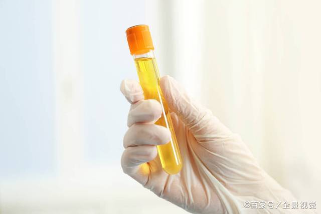 肾脏|尿毒症是怎么引起的？背后离不开这4个原因，聪明的人要学会避开