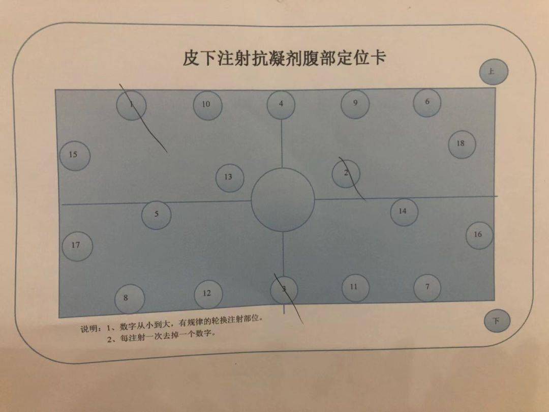 低分子肝素的使用及三种减轻疼痛的注射方法