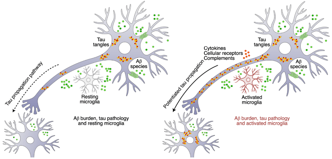 自然医学阿尔茨海默病的生物学定义或许要改写了首个人体研究证实神经