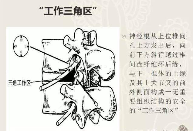 腰椎棘突在针刀定位治疗中的应用!