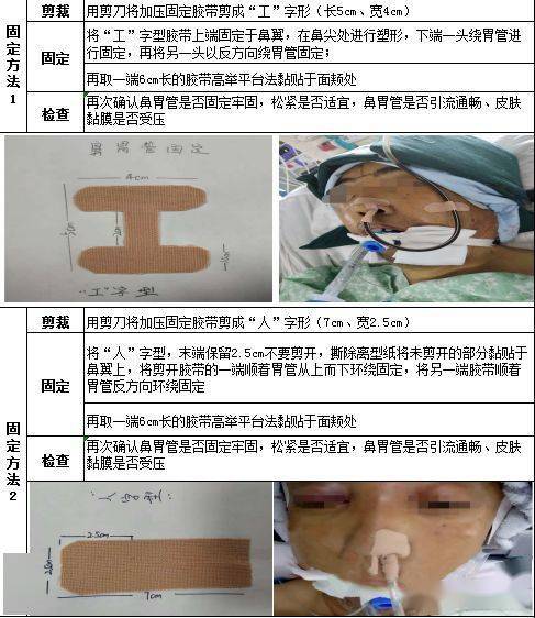 鼻饲患者常见并发症的预防与处理