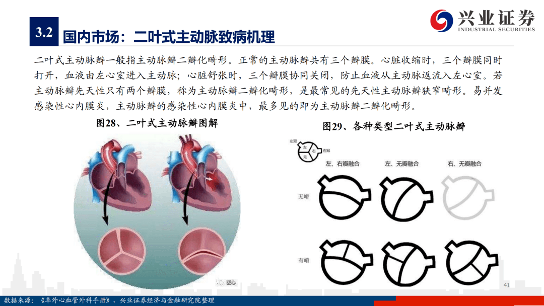 医疗:"心"之所向,新赛道大市场-论心脏瓣膜市场发展现状及未来空间