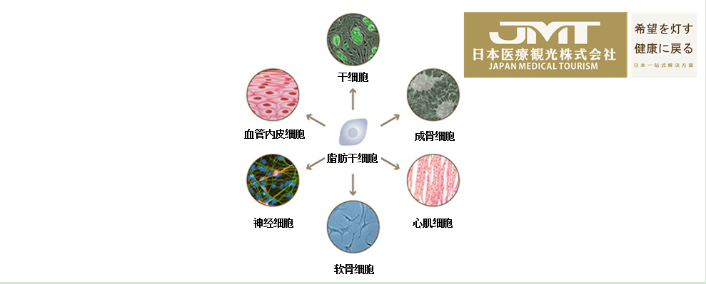 jmt日本干细胞-关于干细胞移植疗法