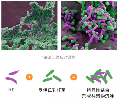 利用罗伊氏乳杆菌的物理特性——表面含有一种黏附分子,将hp缠绕带出