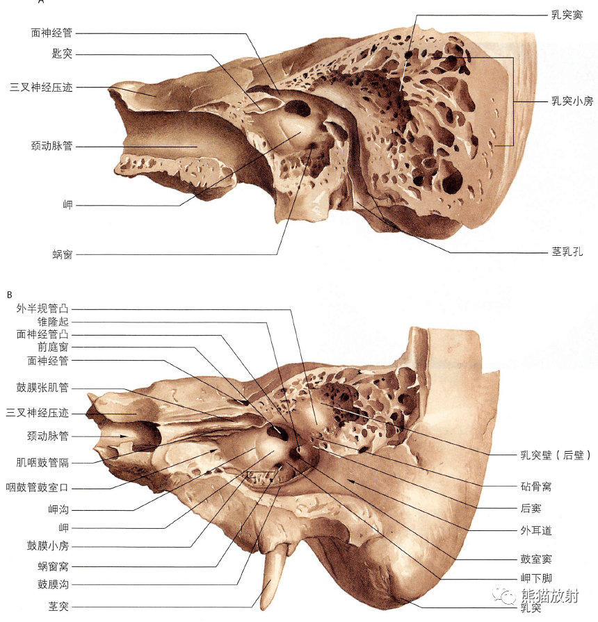 相关中耳结构鼓索神经左侧骨迷路半规管横切面内耳道底↓ 内容节选自