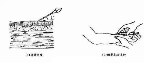 护士常用各种注射法大全
