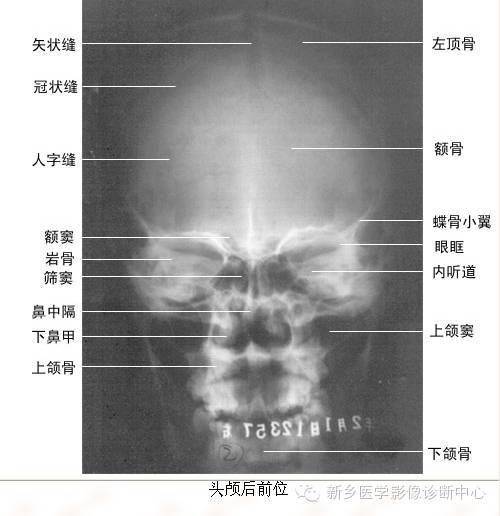 x线解剖图谱这里基本全了