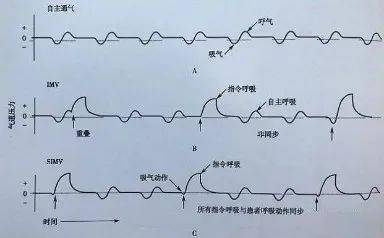 呼吸机使用指南:让护士碰到呼吸机参数不再慌!_患者_压力_气道