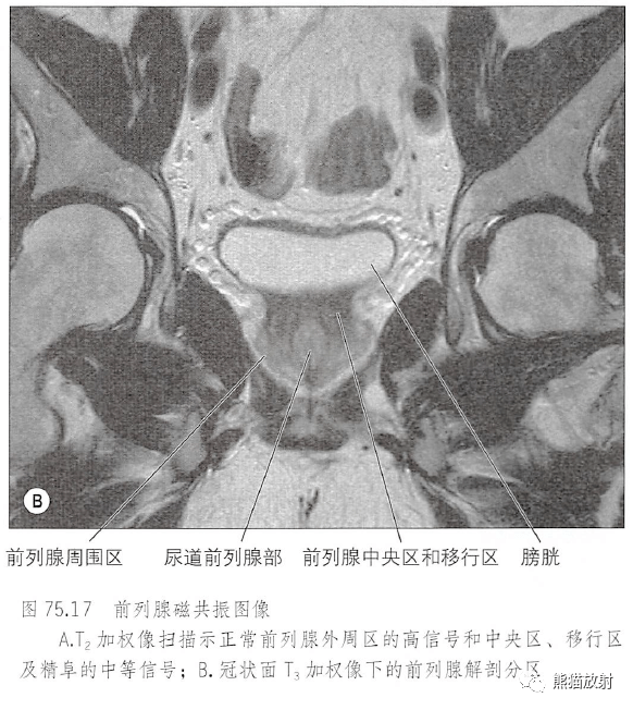 解剖丨膀胱前列腺尿道生殖系统