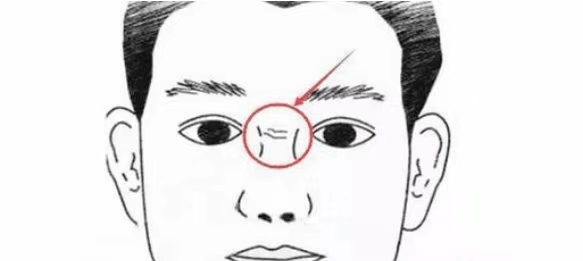 10种面相是疾病信号~_心脏_抬头纹_身体