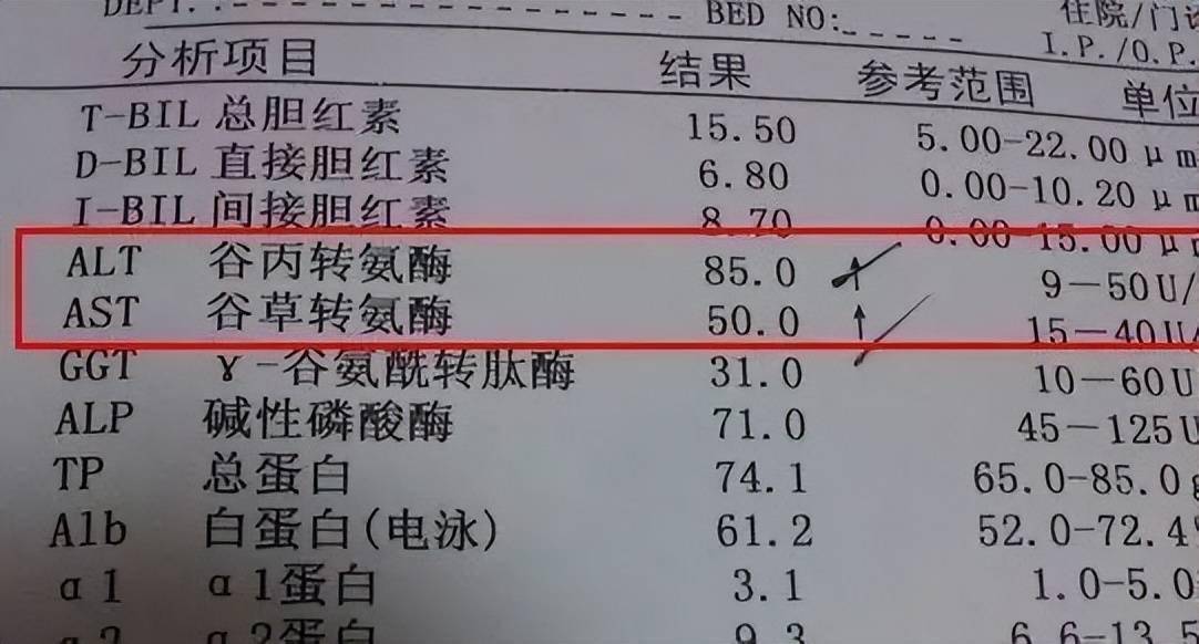 为何体检时肝功能正常结果却查出肝癌晚期医生4个检查别漏掉