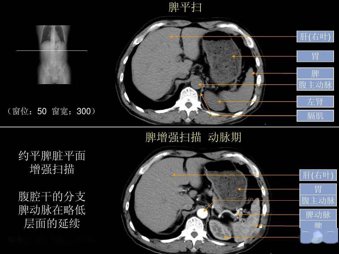 超细的腹部ct入门精美解剖图谱_图像_血管_器官