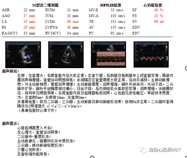 反复心衰住院 15 次,nt-probnp 4091 pg/ml,如何救治?_mmhg_治疗_qd