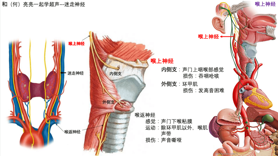 和何亮亮一起学超声技巧系列聚焦迷走神经系列之一巧识喉上神经