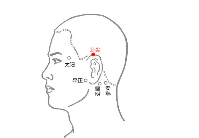 治眼生翳膜,用小艾炷五壮"此法至今仍广泛应用于临床.