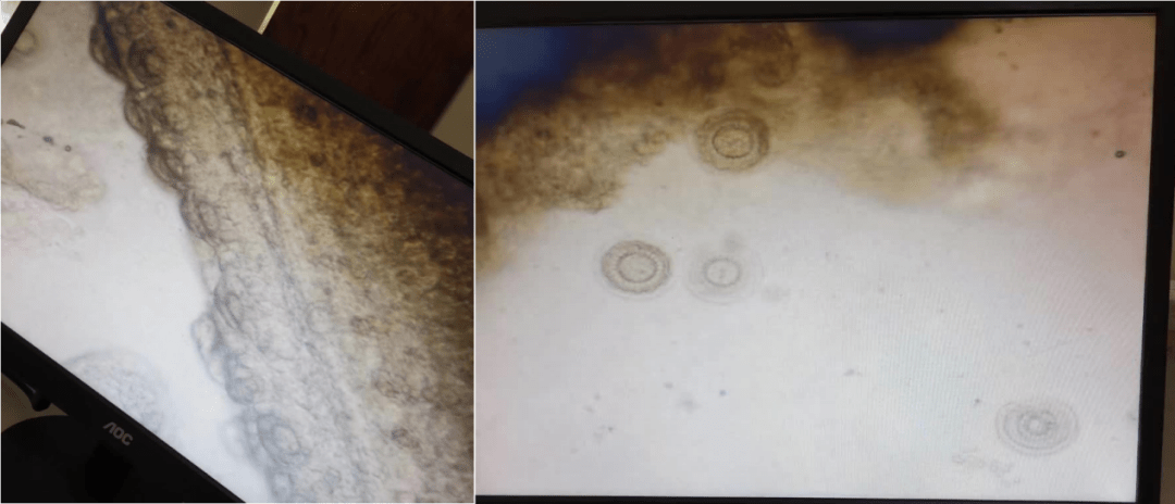 当鳜鱼出现这些现象,很可能是被车轮虫,指环虫盯上了_寄生虫_水质