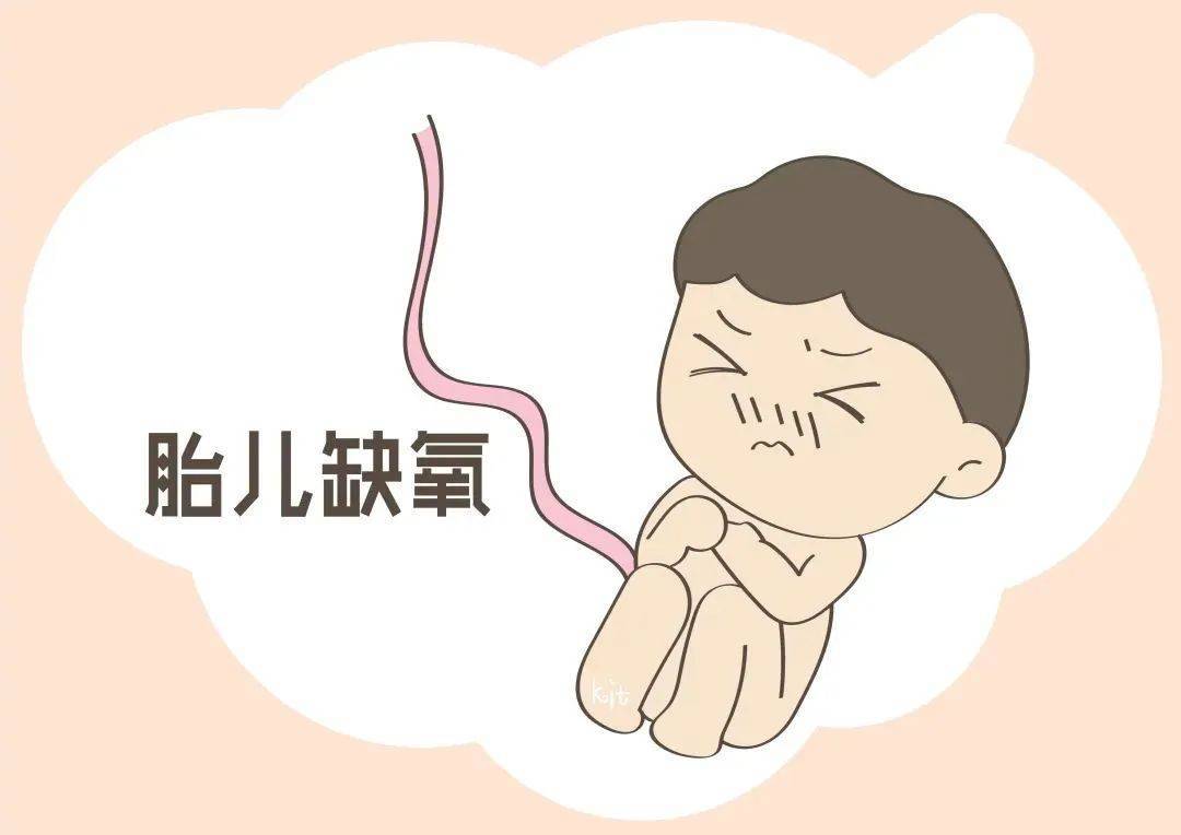 很多孕妈却没读懂,错失挽救时机_胎儿_医生_孕妇