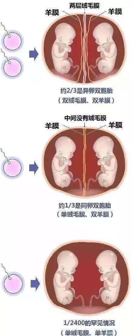 生物羊膜 来自搜狐网