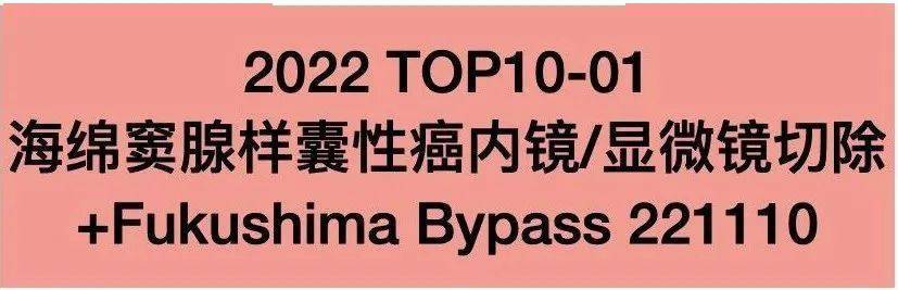 【2022年】佟小光＆Miranda年度手术TOP10