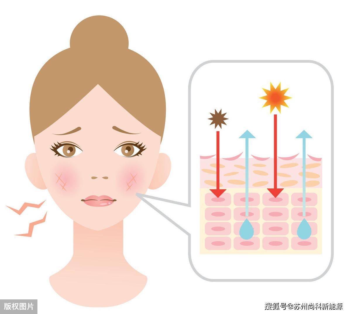 紫外線滅蚊燈對人體傷害有多大?