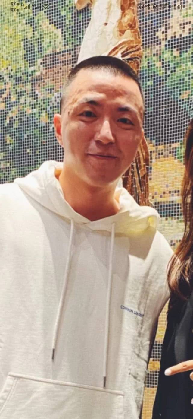 原创青2庆功宴照曝光jonyj真实皮肤状态极差被嘲是月球表面