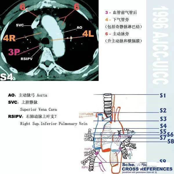 今日分享纵隔淋巴结分区图谱