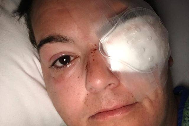 美国记者报道抗议活动,眼球被警察打爆致永久失明:制度令人绝望