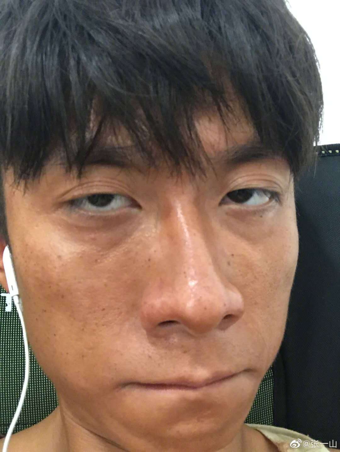 张一山拍戏晒得像猴子,皮肤如黑炭表情忧愁