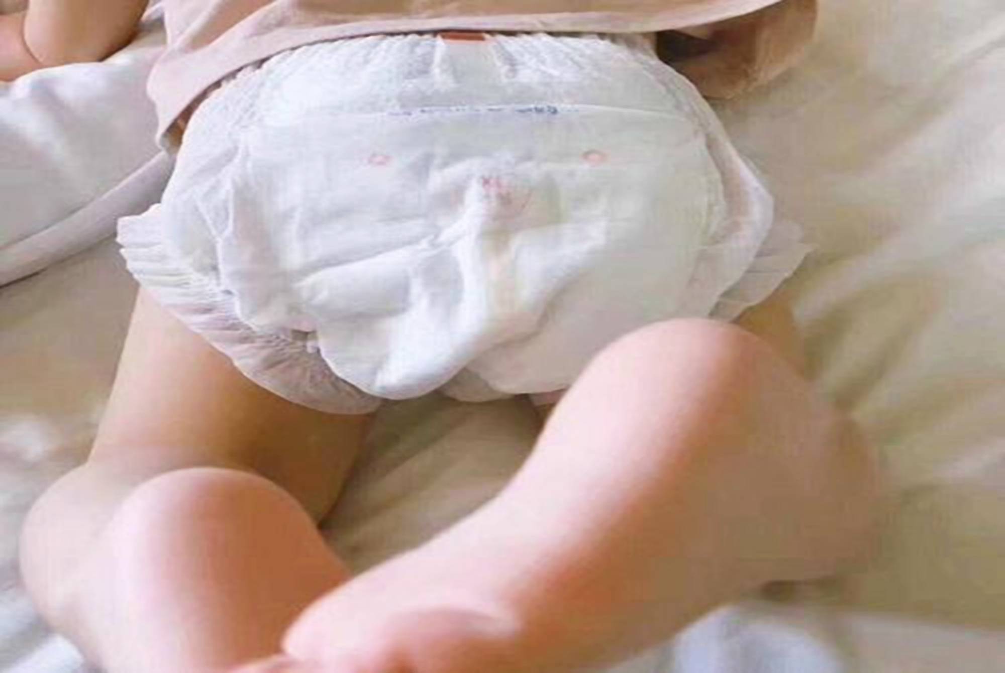 原创宝宝穿纸尿裤会导致o型腿?纸尿裤:这锅我不背,我要辟谣
