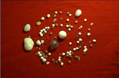 舍利子的化学成份是什么?