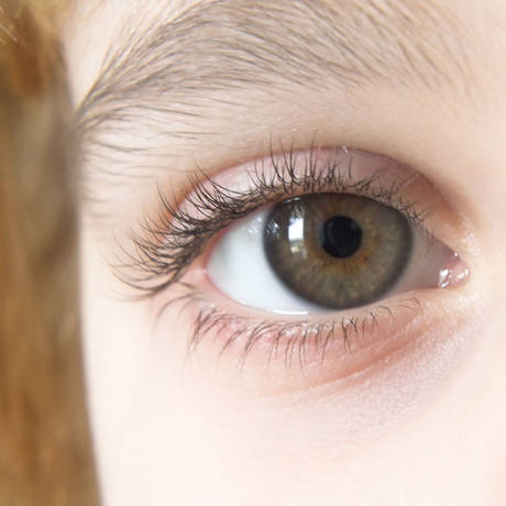 周扬青素颜视频整形疤痕明显,网友表示力挺!_双眼皮