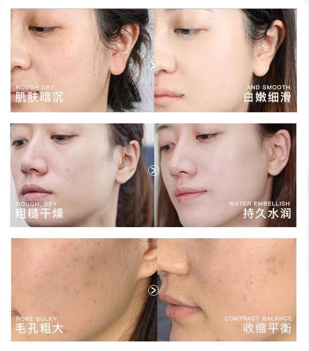 首款微生态护肤爆品亮相上海博览会 | 现场体验,现场定制!