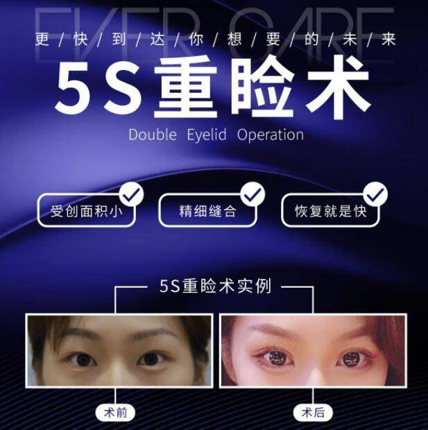 暑期美眼必选青岛伊美尔5s重睑术不做美眼流水线